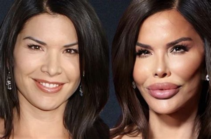 Big Brother: Has Angela Rummans Done Plastic Surgery? Then And Now Pictures On IG 