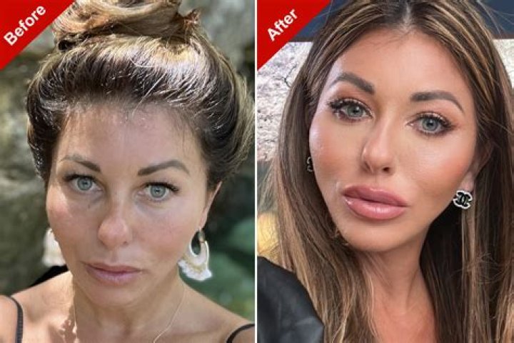 Has Jonathan Cheban Had Plastic Surgery? 