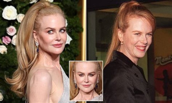 Has Nicole Kidman Had A Boob Job? Unraveling The Truth Behind The Rumors