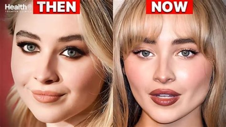 The Unfiltered Truth About Sabrina Carpenter's Plastic Surgery Journey