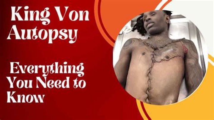Unraveling The Mystery Behind King Von Autopsy Pictures