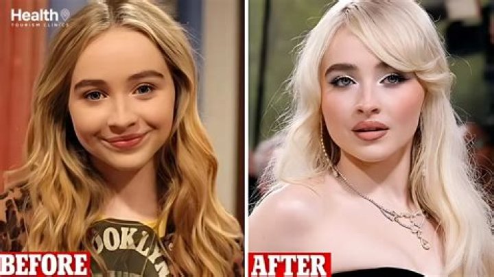 Unveiling The Truth: Did Sabrina Carpenter Get Face Surgery?