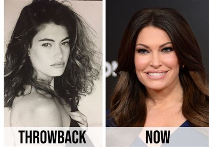 Unveiling The Truth: Kim Guilfoyle Plastic Surgery Journey