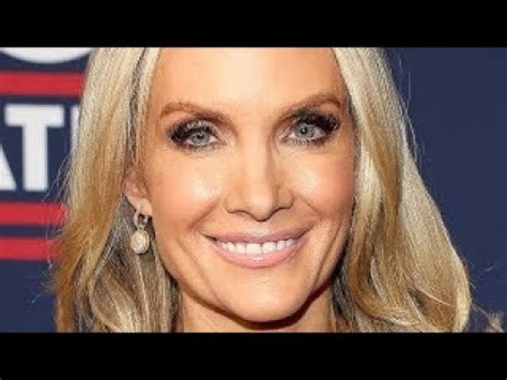 What Happened To Dana Perino Nose On Fox News, Is She Leaving? Husband and Salary