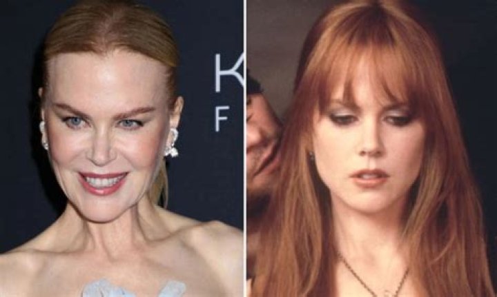 Why Nicole Kidman's Fillers Are The Talk Of The Town