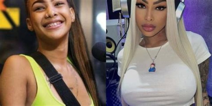 Yailin La Mas Viral Before Surgery Pictures, Did She Get Plastic/Cosmetic Surgery on Her Face?